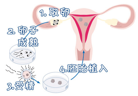 林院长